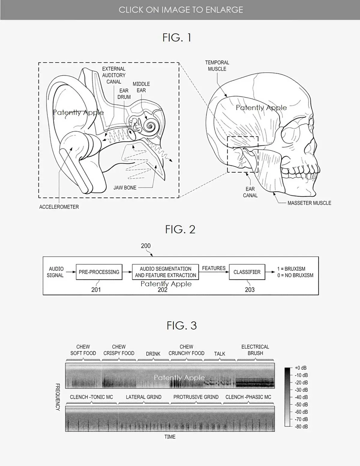 AirPods, in un brevetto di Apple diagnosi e monitoraggio bruxismo AirPods, in un brevetto di Apple diagnosi e monitoraggio bruxismo