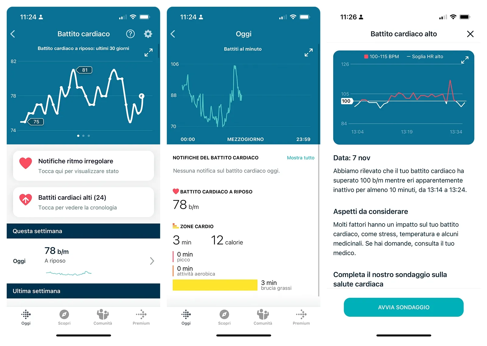 Recensione Fitbit Inspire 3, bracciale smart semplice, accessibile ma per utenti comunque esigenti Recensione Fitbit Inspire 3, bracciale smart semplice, accessibile ma per utenti comunque esigenti