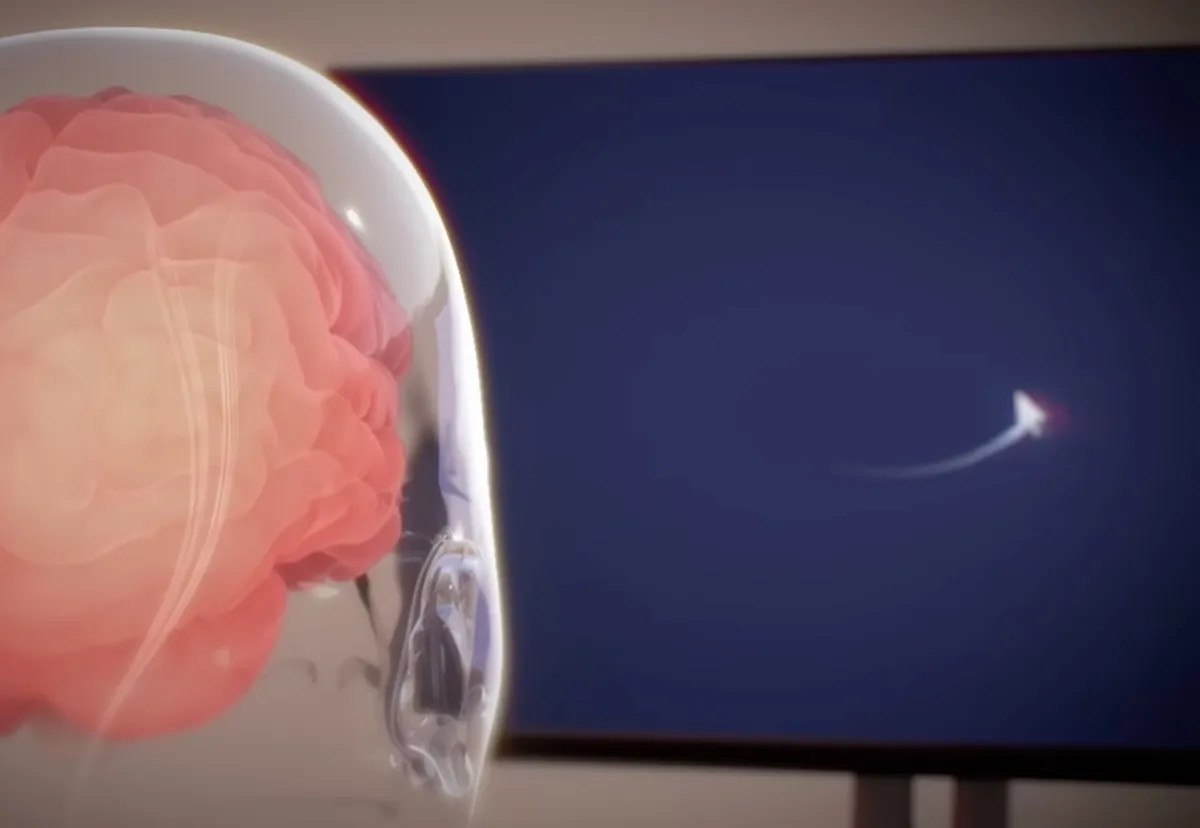 Elon Musk annuncia primo impianto cerebrale Neuralink su un umano Elon Musk annuncia primo impianto cerebrale Neuralink su un umano