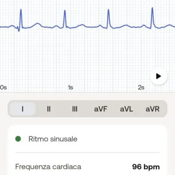 In prova Withings Body Scan, non chiamatela semplice bilancia